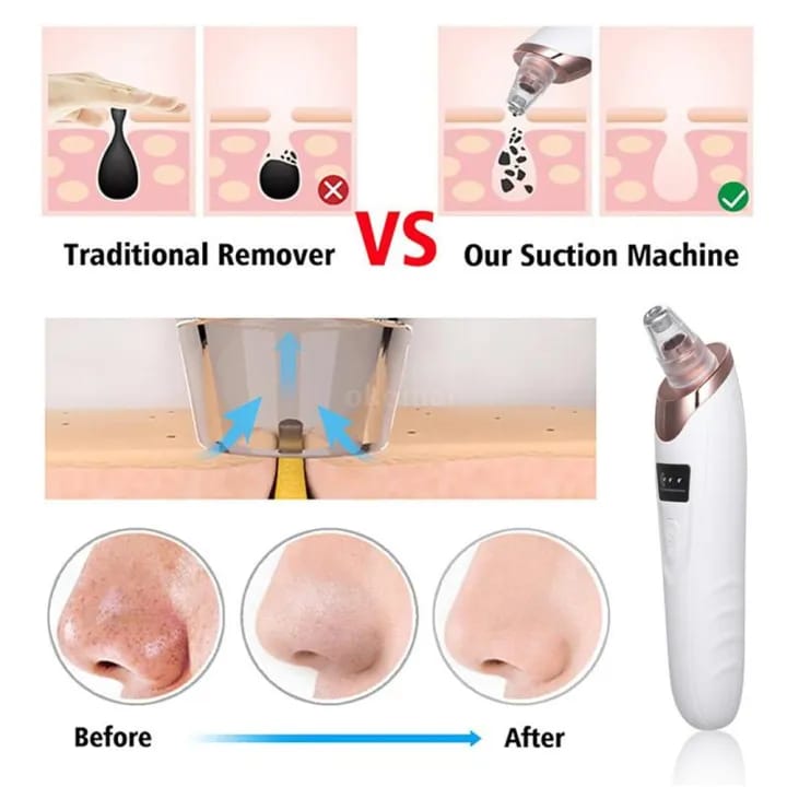 Blackhead Remover & Deep Cleansing Vacuum Multifunctional Electric Pore Cleaner